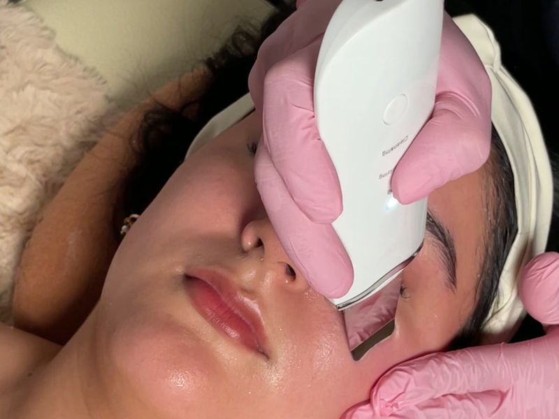Limpieza facial con equipo